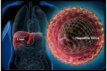 Kronik Viral Hepatit B Belirtileri ve Tedavisi